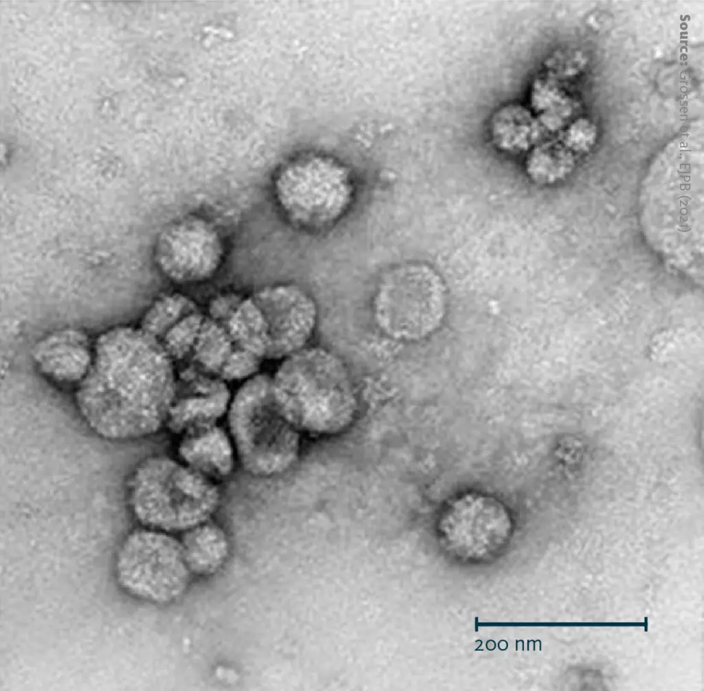 A transmission electron microscopy (TEM) image of purified bovine milk extracellular vesicles after uranyl acetate negative staining. The magnification is 50’000x, the scale bar in the bottom left represents 200 nm.