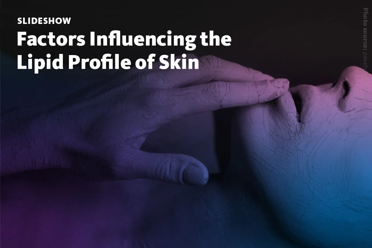 Slide 1: A slideshow about factors influencing the lipid profile of skin and thus functional skin parameters, and the relevance to dermatology and cosmetics research.