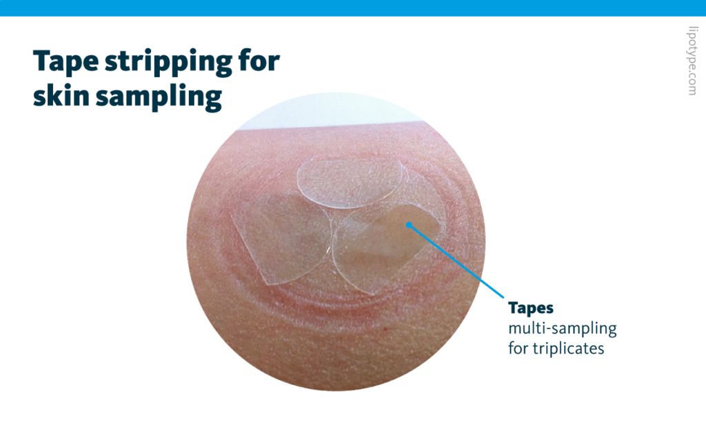 A skin sampling tape disc is placed on the respective body part and peeled off after a few seconds of pressure. Skin sticks to the tape, and its sebum lipids and stratum corneum lipids can be extracted for lipidomics analysis. Placing multiple tapes on the same spot at once can be used for quick triplicate sampling, and sequential tape stripping allows for skin depth analysis.