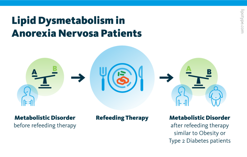 An infographic showing how anorexia nervosa patients exhibit metabolic disorder before refeeding therapy and after refeeding therapy. Yet, after intervention the metabolic disorder is more similar to obesity and type 2 diabetes.