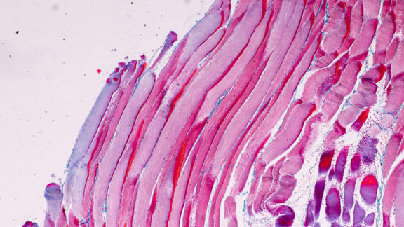 The title image of the Lipidomics Webinar "Shotgun Lipidomics of Tissue Biopsies" with Andrej Shevchenko.