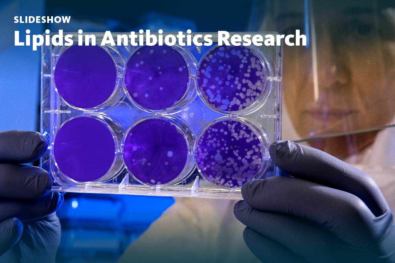 Slide 1: A slideshow about lipids in antibiotics research.