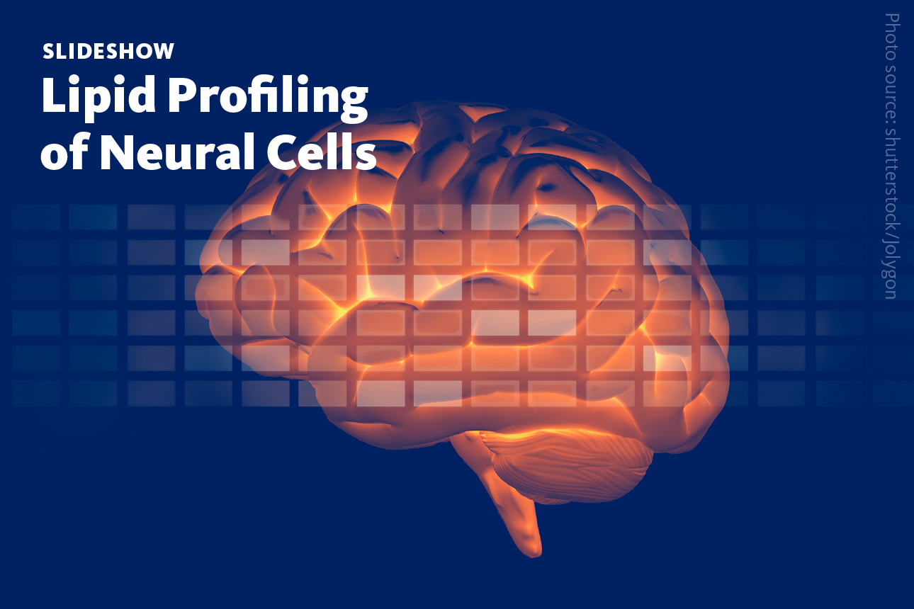 Slide 1: A slideshow about the distinct lipid profiles of neural cells such as neurons, oligodendrocytes, microglia, and astrocytes and the benefits of lipidomics for neurobiology.