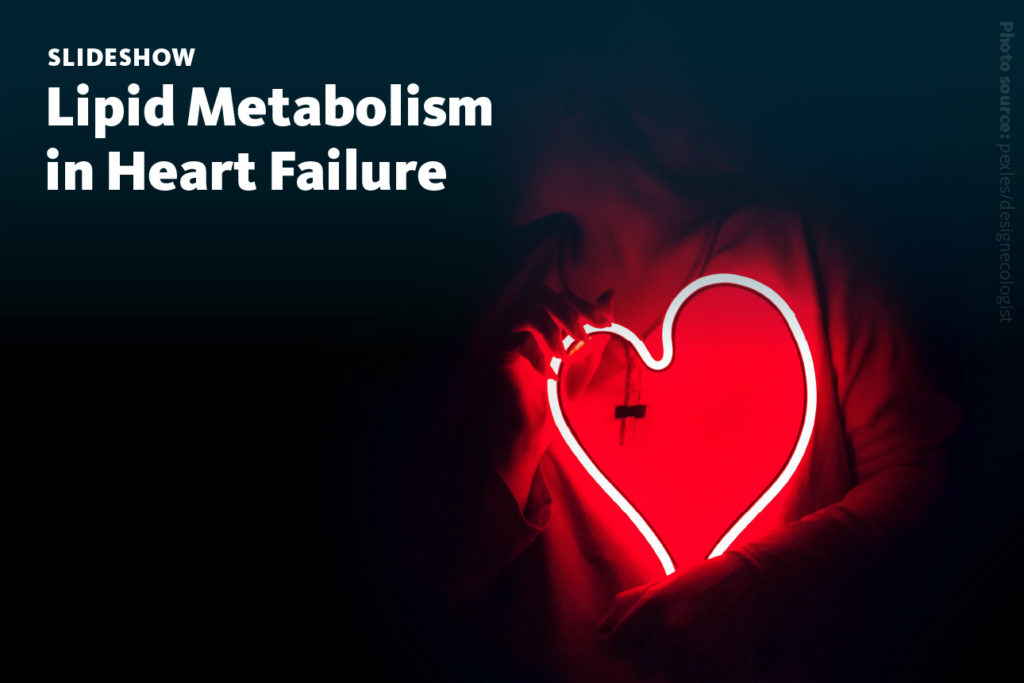 Slide 1: A slideshow about translating cardiac lipid metabolism profiles of heart tissue samples of the model organism mice to human blood plasma samples.