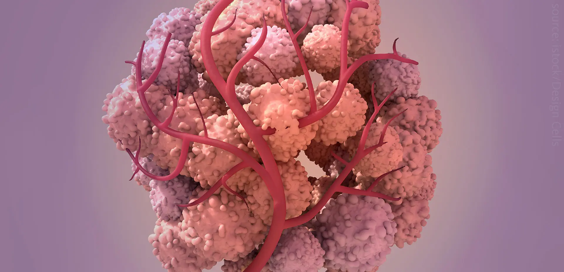 A scientific computer render of vascularized cancer tissue.