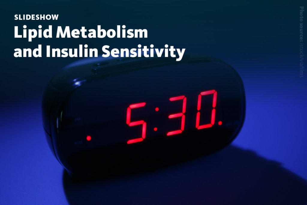 Slide 1: A slideshow about how plasma lipid profiles depend on meal timing and composition and how they are associated with insulin sensitivity.