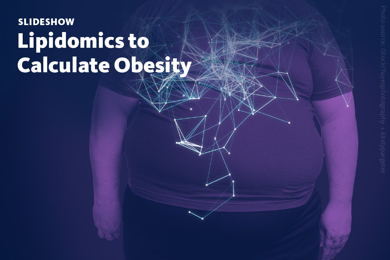 Slide 1: A slideshow about calculating obesity from lipidomics data as a new clinical metabolic indicator for metabolic obesity.