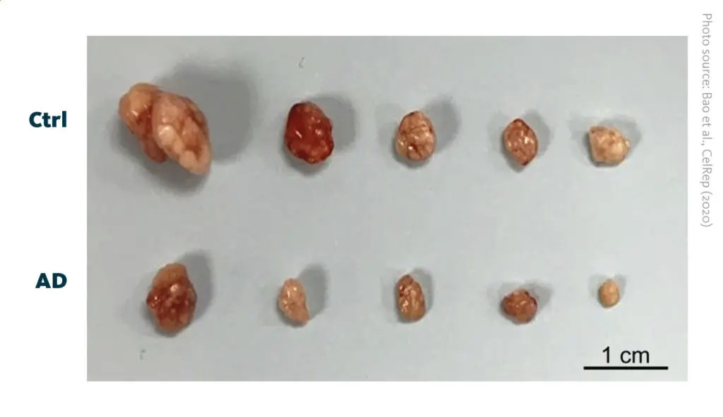 Images of tumors from control (Ctrl) and alexidine dihydrochloride treated (AD) mice. AD tumors are smaller than Ctrl tumors. Images of tumors from control (Ctrl) and alexidine dihydrochloride treated (AD) mice. AD tumors are smaller than Ctrl tumors.