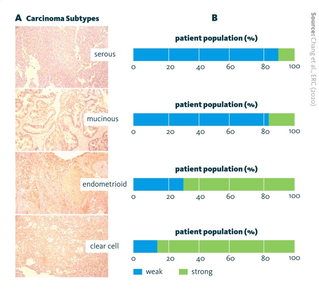 (A) Immunohistochemistry staining of LDLR. (B) Quantitation of Immunohistochemistry scores (IHC scores) of LDLR. The patient numbers are serous (S, n = 16), mucinous (M, n = 29), endometrioid (E, n = 50), and clear-cell (C, n = 20). ‘Strong’ indicates an IHC score of 3 or above; ‘weak’ indicates an IHC score lower than 3.