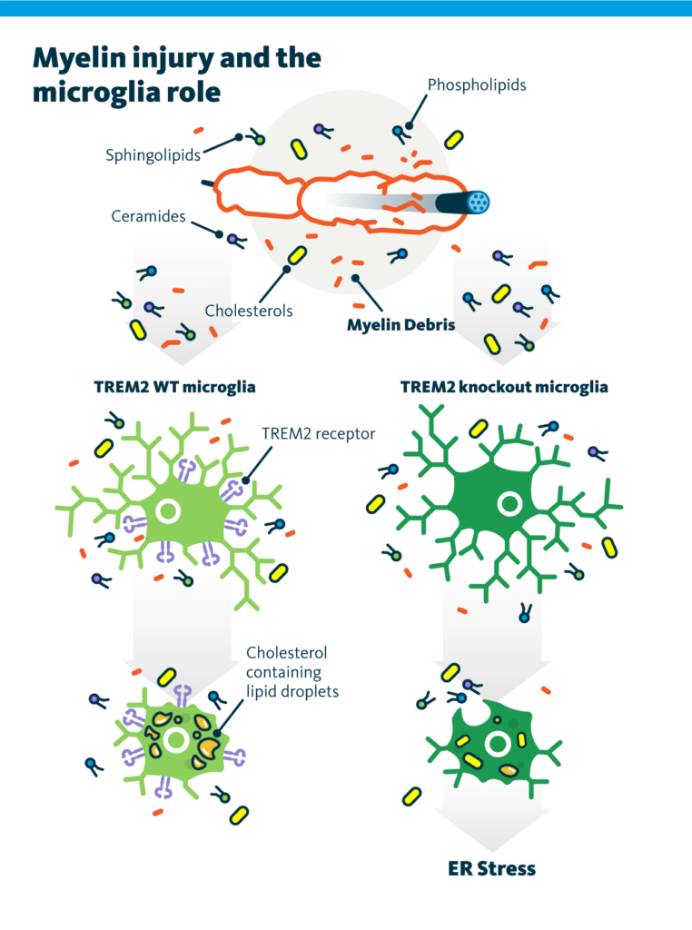 An infographic visualizing TREM2 WT and TREM2 knockout microglia dealing with cholesterol from the myelin debris following myelin injury. TREM2 knockout microglia cells cannot process cholesterol which causes ER stress in these microglia. An infographic visualizing TREM2 WT and TREM2 knockout microglia dealing with cholesterol from the myelin debris following myelin injury. TREM2 knockout microglia cells cannot process cholesterol which causes ER stress in these microglia.