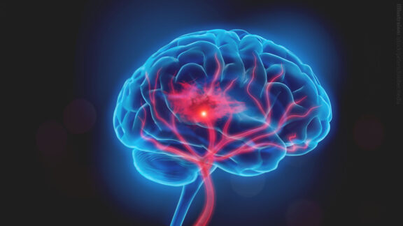 The title image of the Lipidomics Webinar "Role of Lipids in Central Nervous System Regeneration" with Mikael Simons.
