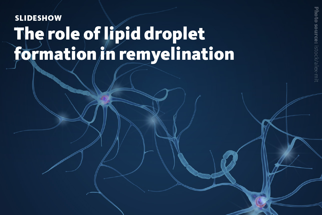 Slide 1: A slideshow about the role of lipid droplet formation in remyelination.