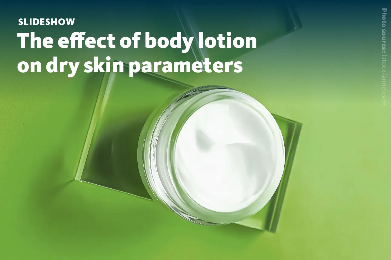 Slide 1: The effecct of body lotion on dry skin parameters.