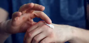 A close photo of hands where the person applying creme to hands.