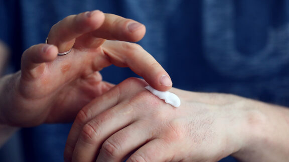 A close photo of hands where the person applying creme to hands.