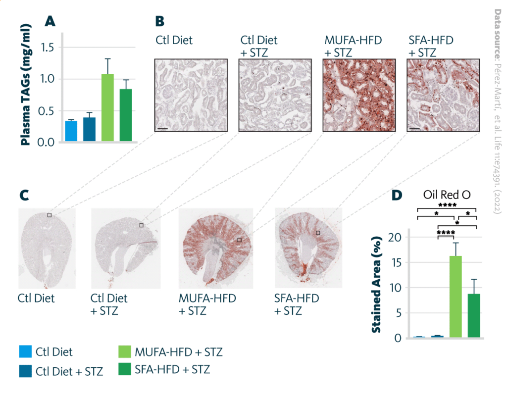 Accumulation Of Neutral Lipids In Kidney Upon Treatment With High Fat Diet And Monounsaturated Fatty Acids High Fat Diet