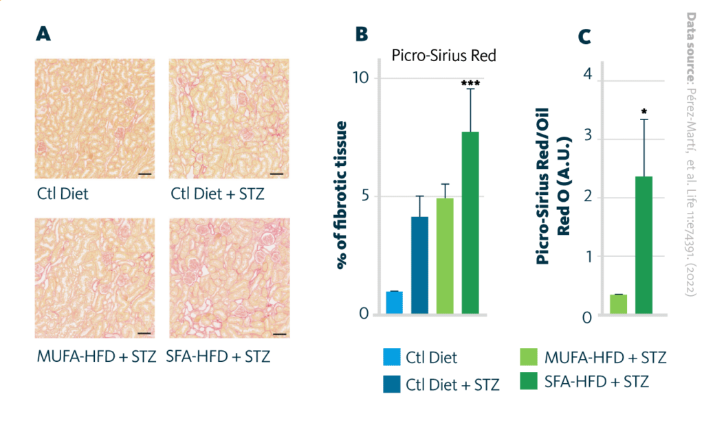 Induction Of Tubular Damage By Saturated Fatty Acids High Fat Diet And Monounsaturated Fatty Acids High Fat Diet