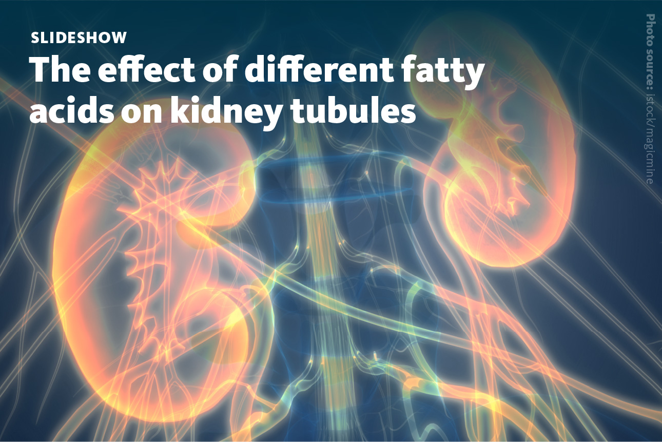 Title Slide: The effect of different fatty acids on kidney tubules