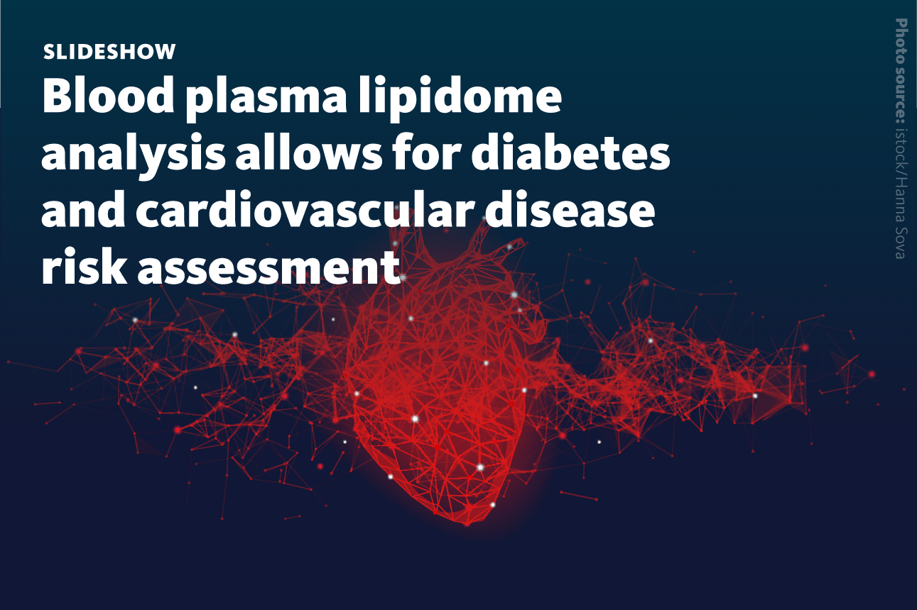 A slide show describing that blood plasma lipidome analysis allows for diabetes and cardiovascular disease risk assessment