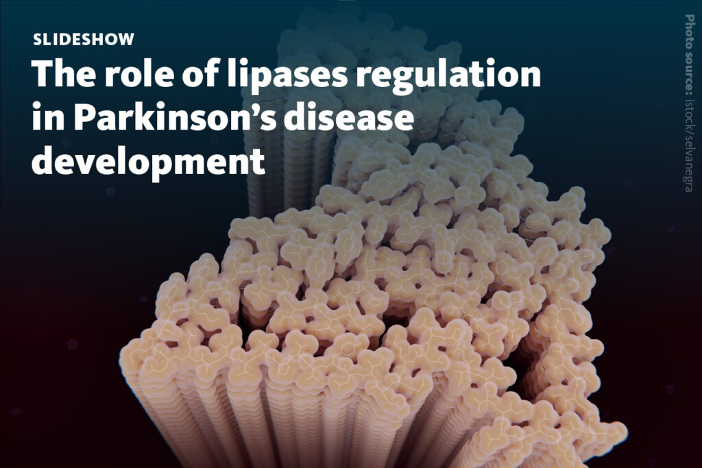 Slide 1 The Role Of Lipases Regulation In Parkinsons Disease Development