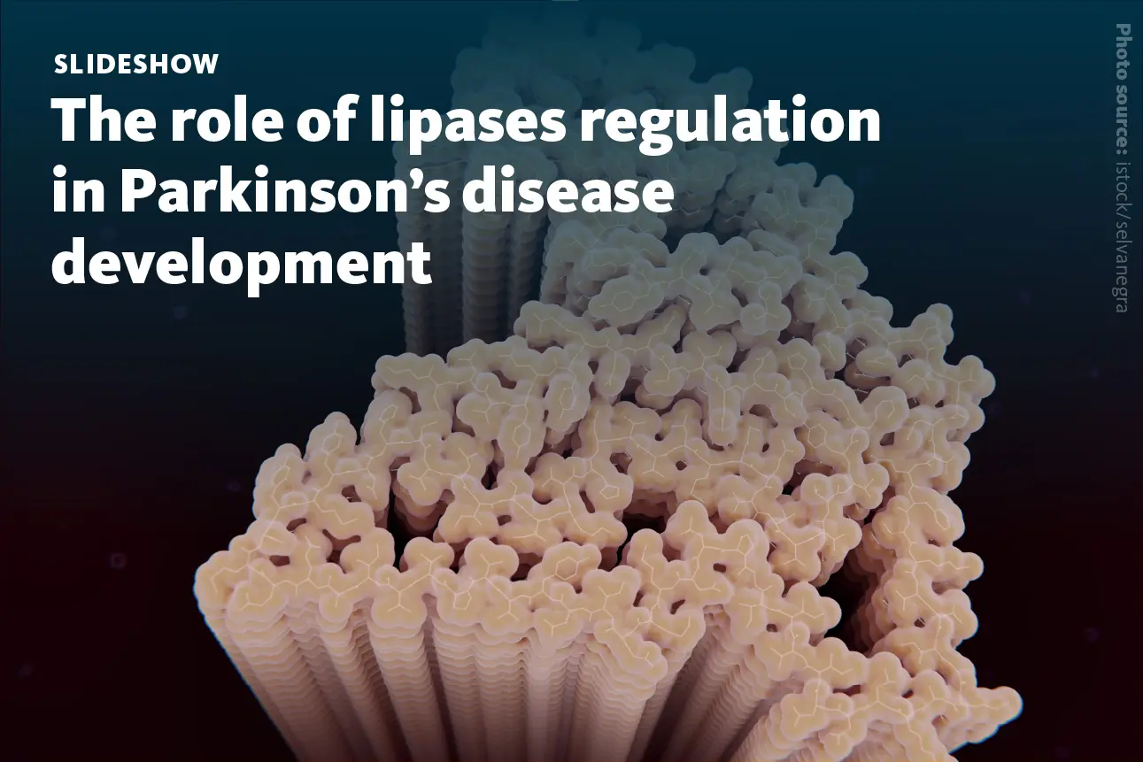 Slide 1 The Role Of Lipases Regulation In Parkinsons Disease Development