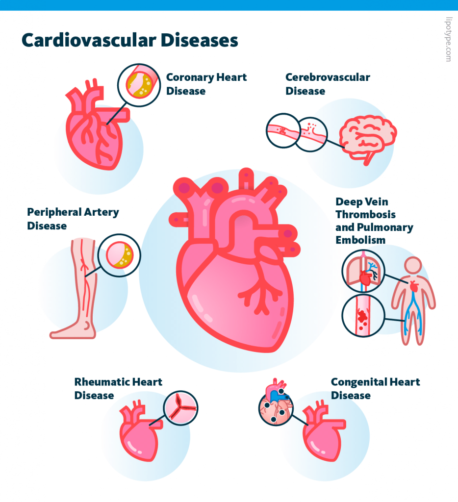 The image showing various Cardiovascular Diseases: coronary heart disease, cerebrovascular disease, deep vein thrombosis and pulmonary embolism, congenital heart disease, rheumatic heart disease, peripheral artery disease.