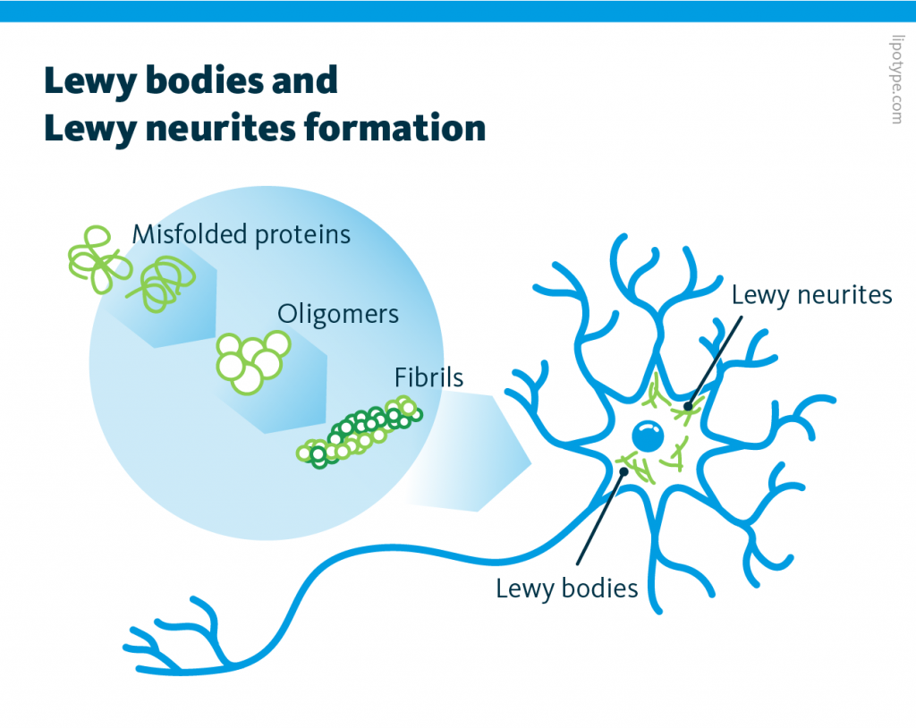 A schematic representation of Lewy bodies and Lewy neurites formation. It is visualized on the image that misfolded proteins form oligomers that then form fibrils. Lewy bodies and Lewy neurites include these fibrils in their composition.