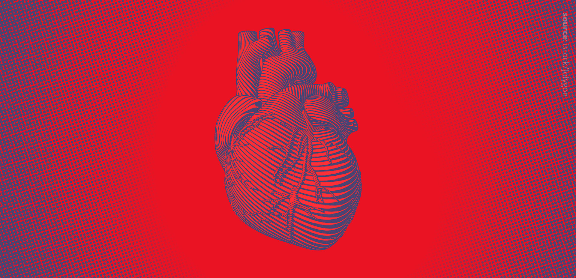 Lipidomics of cardiovascular diseases