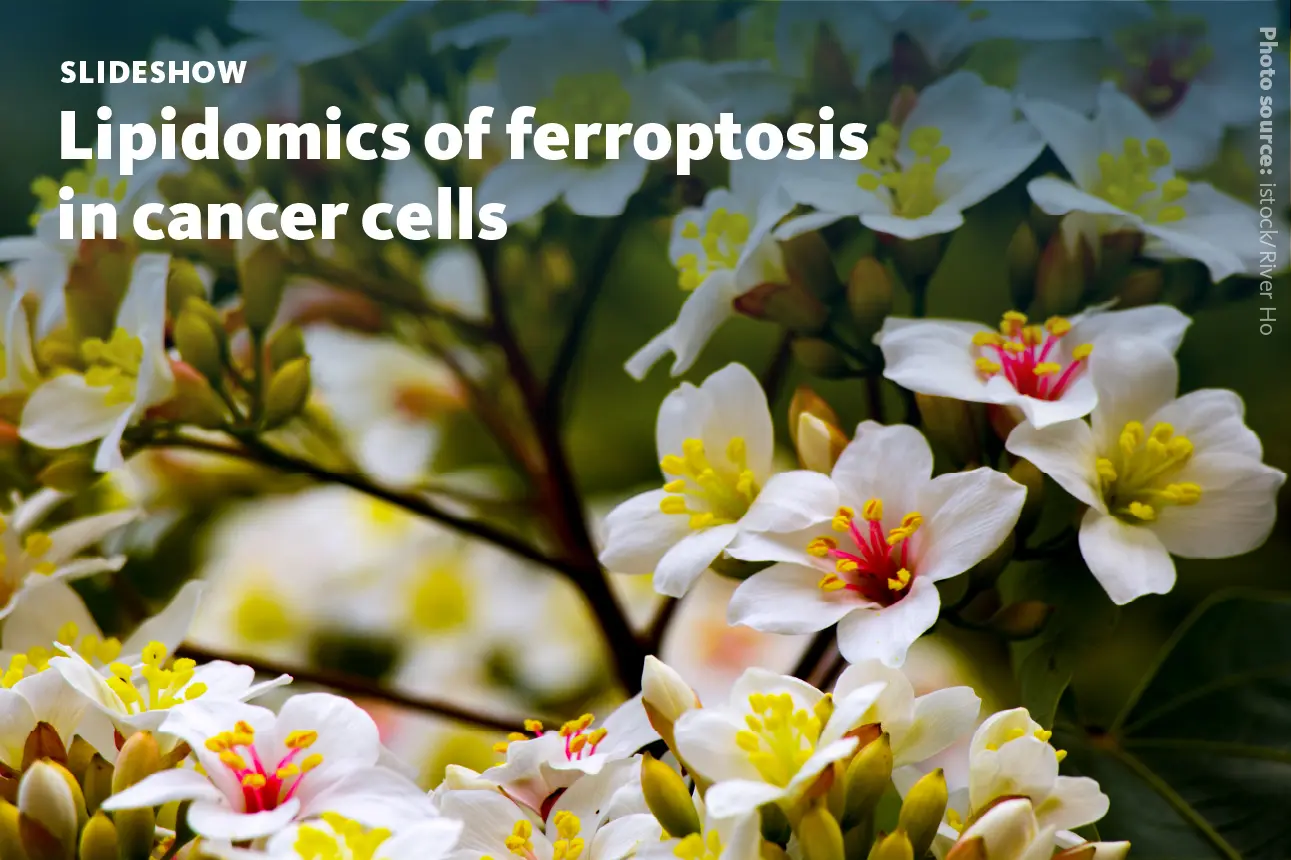 Slide 1: Lipidomics of ferroptosis in cancer cells.