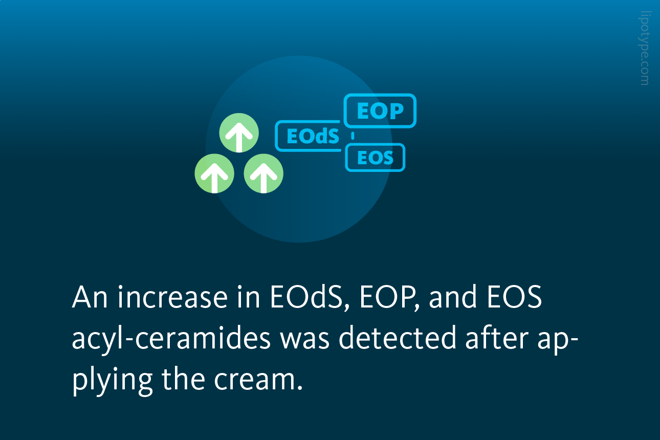 Slide 4: An increase in EOdS, EOP, and EOS acyl-ceramides was detected after applying the cream.