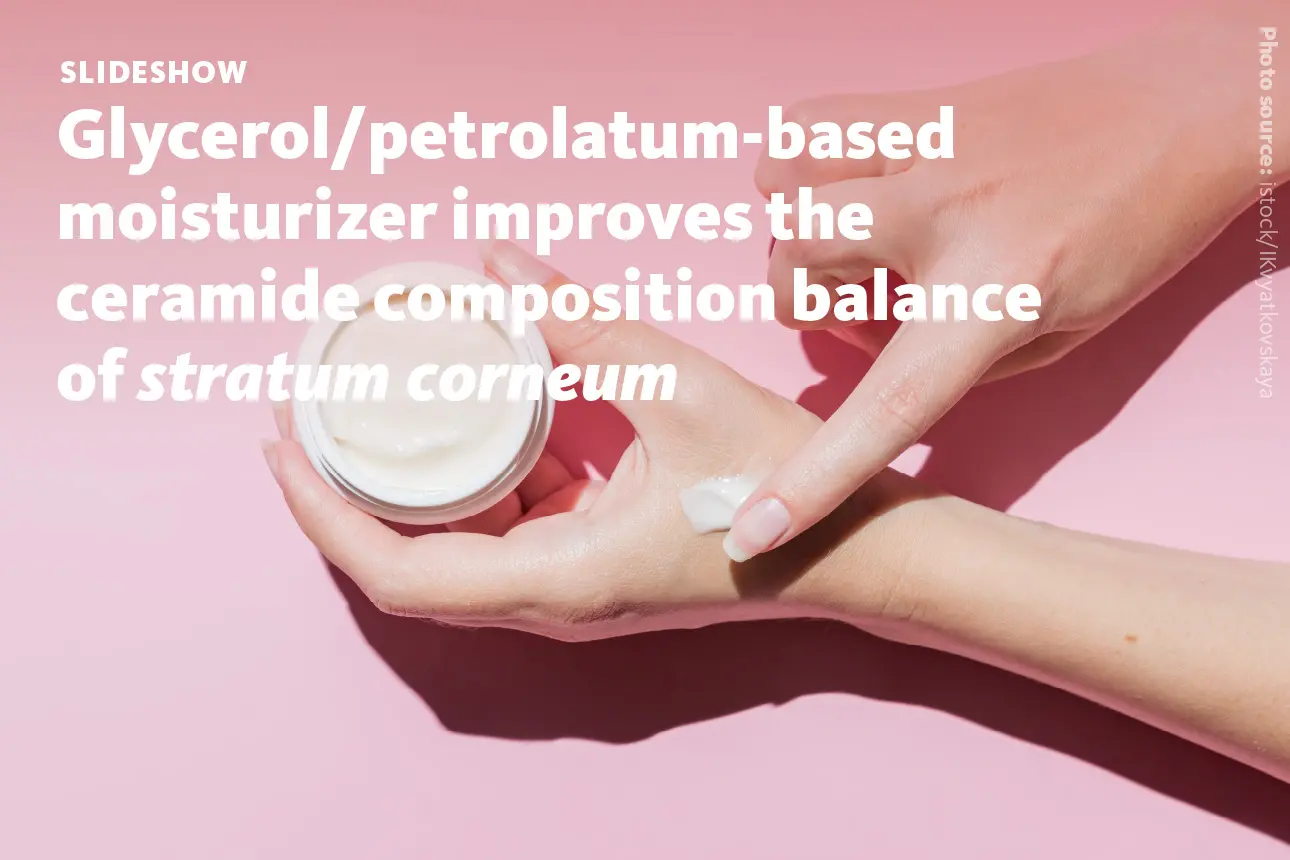 Slide 1: Glycerol/petrolatum-based moisturizer improves the ceramide composition balance of stratum corneum.