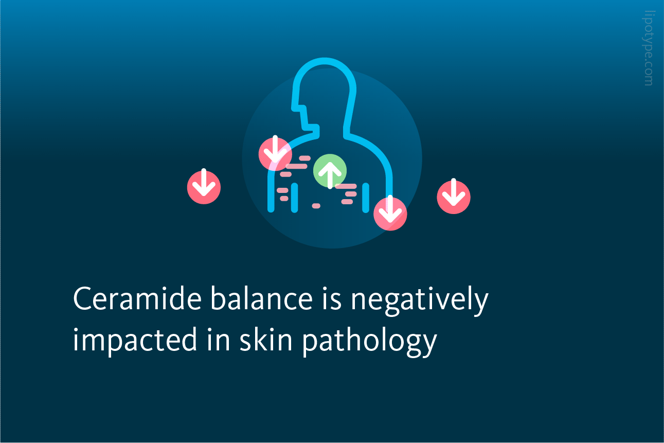 Slide 6: Ceramide balance is negatively impacted in skin pathology
