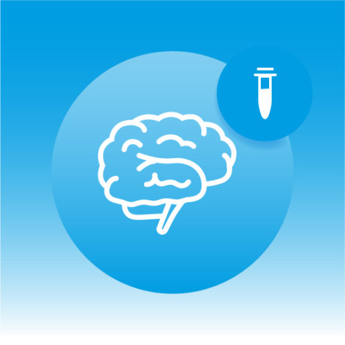 Premium Human CSF Lipidomics