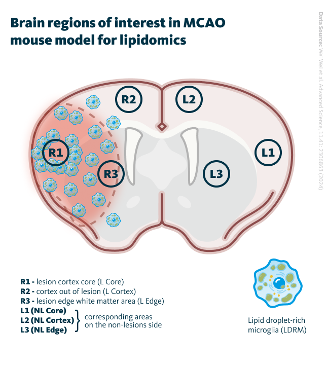 Brain regions of interest in MCAO mouse model for lipidomics. Definition of regions of interest on MCAO-induced mouse brain tissue; (here the definitions of Rs and Ls).