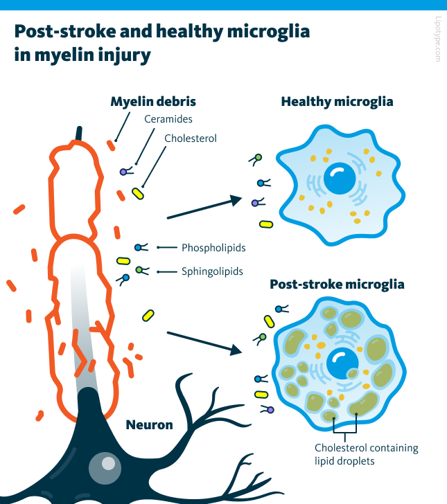 Aged and healthy microglia in myelin injury