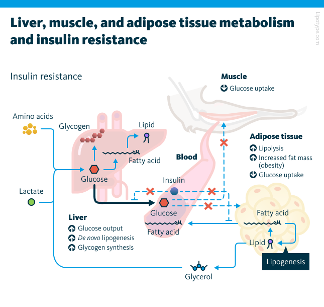 Effects of insulin resistance in the liver, adipose tissue, and muscle. In the liver, glucose output, de novo lipogenesis, and glycogen synthesis are increased. In muscle, glucose uptake is reduced, as is glucose uptake in adipose tissue. Insulin resistance also leads to increased lipolysis and fat accumulation in adipose tissue.