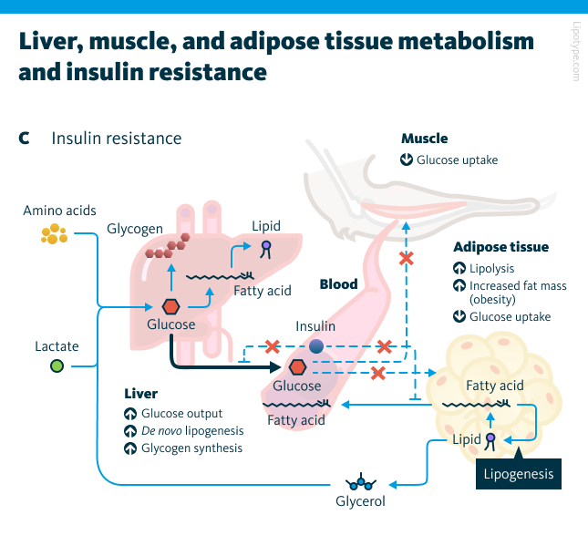 Effects of insulin resistance in the liver, adipose tissue, and muscle. In the liver, glucose output, de novo lipogenesis, and glycogen synthesis are increased. In muscle, glucose uptake is reduced, as is glucose uptake in adipose tissue. Insulin resistance also leads to increased lipolysis and fat accumulation in adipose tissue.