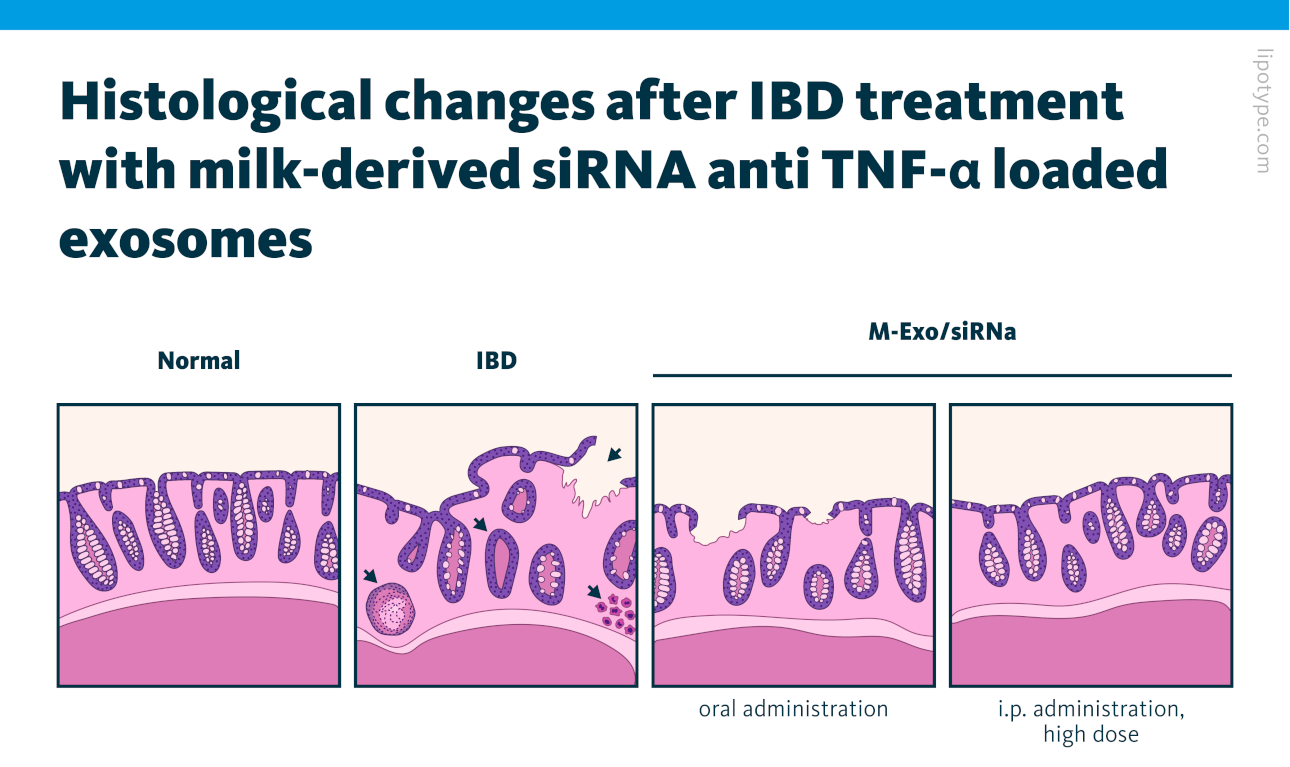 The treatment efficacy of milk-derived exosomes with TNF-α siRNA in cases of oral and intraperitoneal administration types.