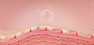 Lipidomics in eczema treatment innovation