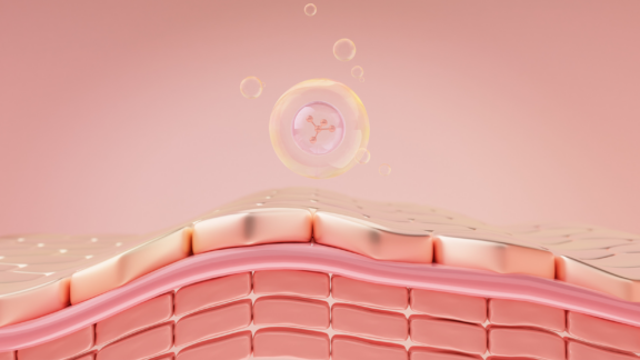 Lipidomics in eczema treatment innovation