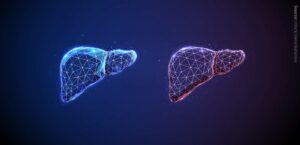 Phospholipid remodelling in fatty liver disease