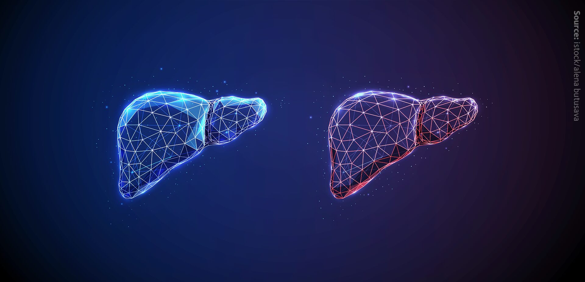 Phospholipid remodelling in fatty liver disease