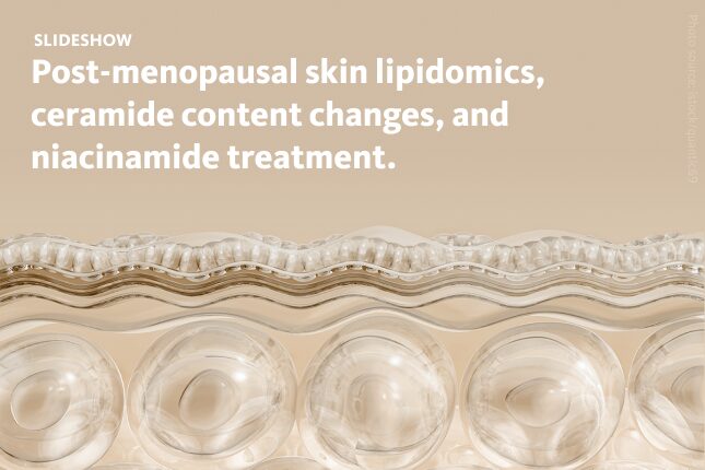 Slide 1: Post-menopausal skin lipidomics, ceramide content changes, and niacinamide treatment.